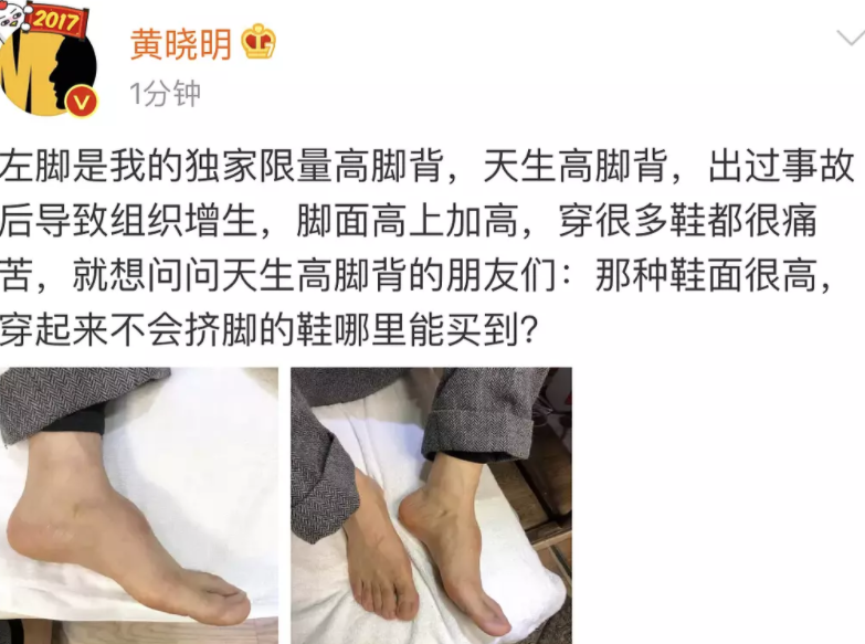 这6位男星，因拍戏差点命不保，一个比一个的“后遗症”严重