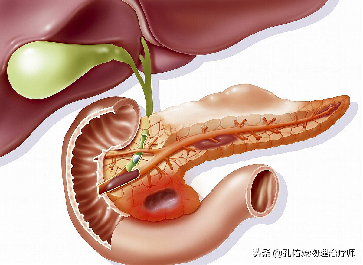 左肩疼痛2月,查出胰腺癌?这几处疼痛,可能是癌症或疾病的征兆