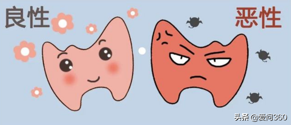 甲状腺有问题的几个表现，预防甲状腺结节的小妙招，你知道几个？