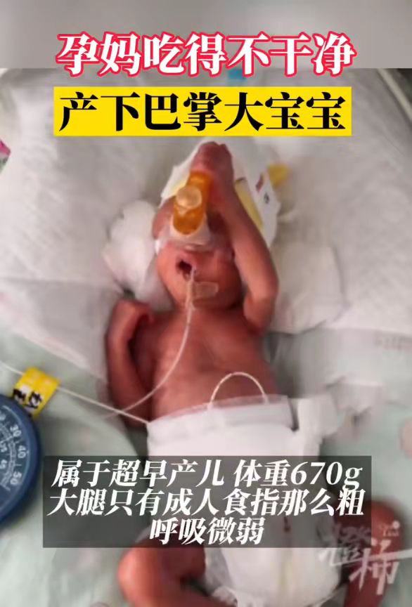 24周孕妈生下“巴掌宝宝”！竟是这种致命菌在搞鬼？你家可能也有