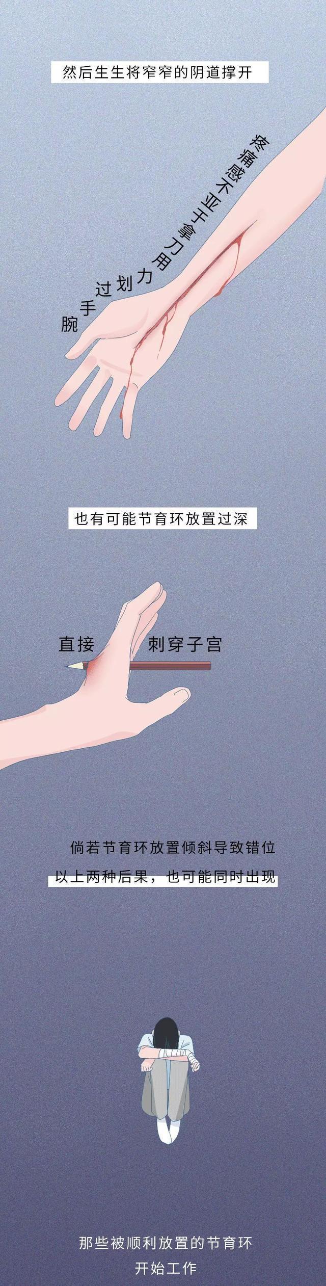 “节育环”长时间在女人体内，会发生什么变化？