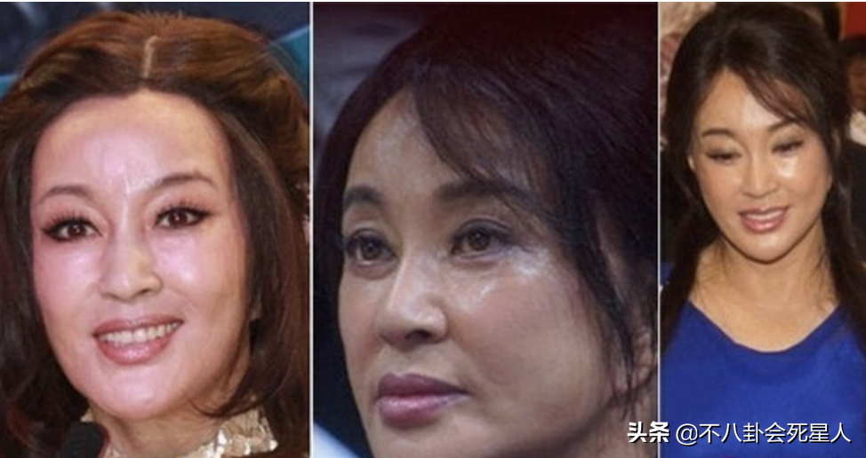 娱乐圈“假下巴”大赏，又尖又翘，一笑下巴原地起飞太吓人