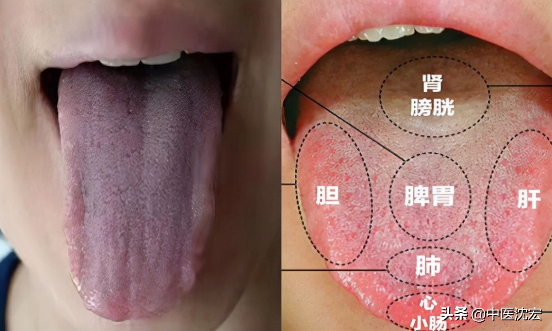 肝郁用逍遥丸不管用？这个妙招可解三焦气郁，消血、湿、痰和瘀滞