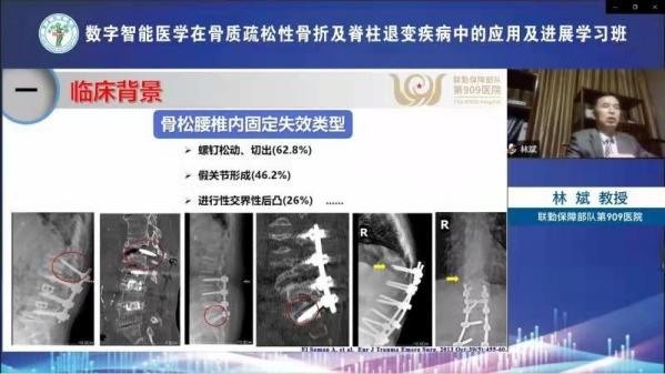 国家级继续教育项目学习班在西安市红会医院顺利召开