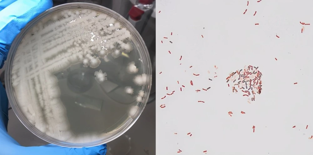 为什么不能乱抠肚脐眼？原来，肚脐眼连的根本不是肠子