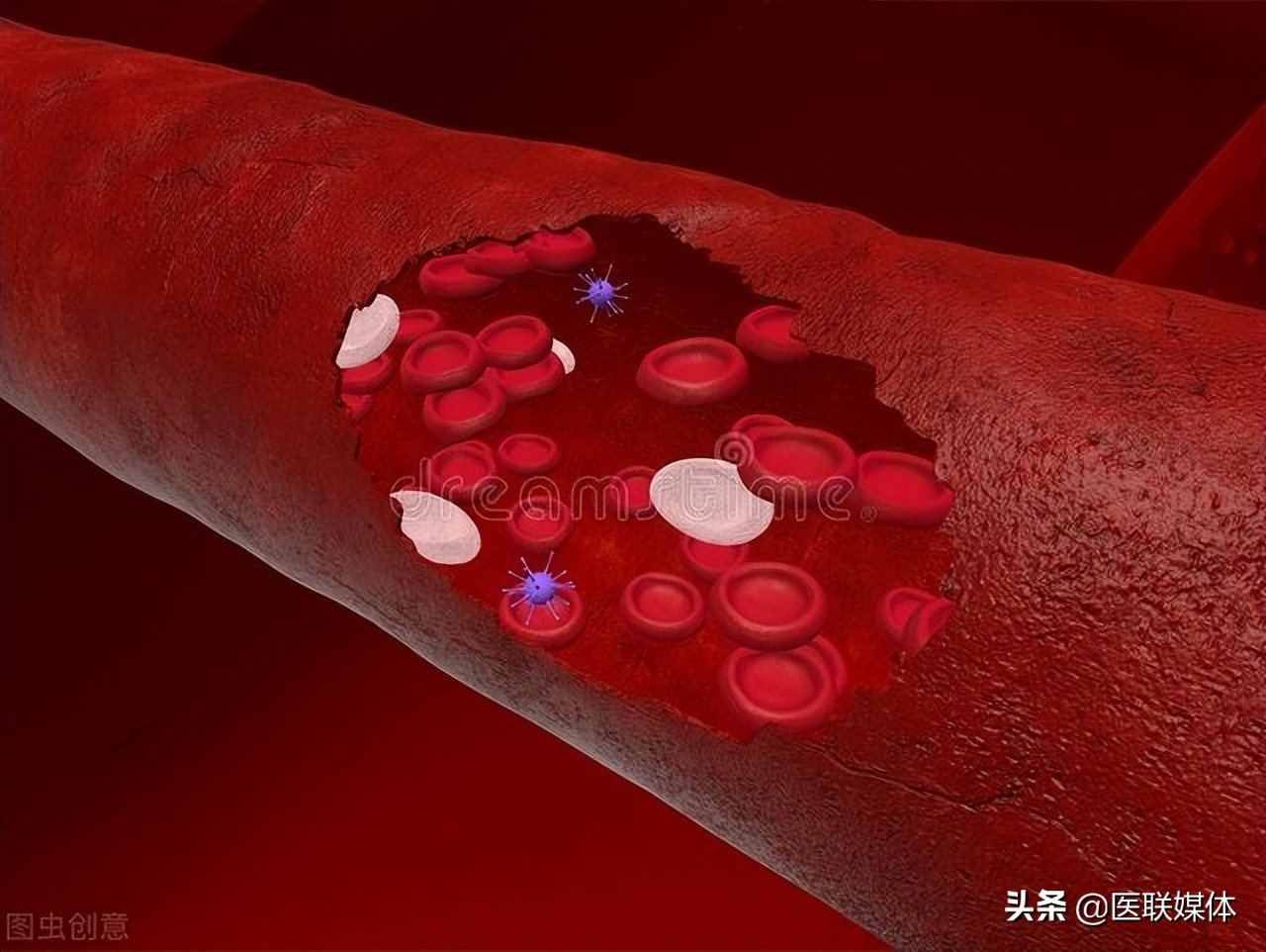 血液粘稠是小事？这3个麻烦事可能也会来，得尽早避开