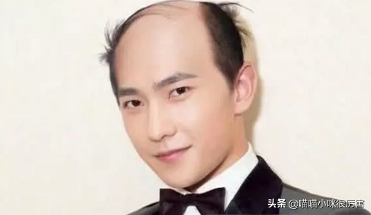 脸型好，只服这10位男星，什么奇葩发型都好看