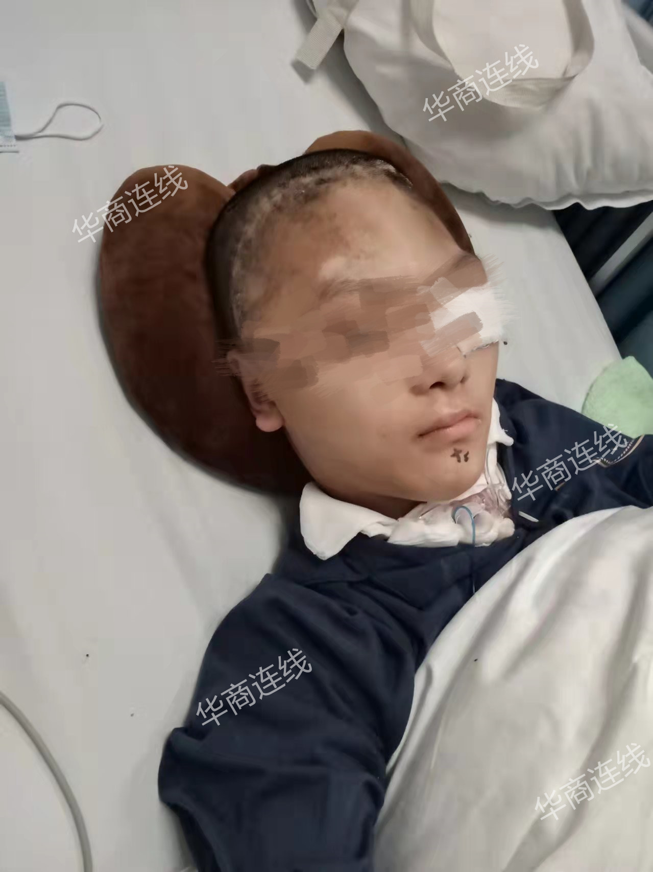 “爸爸，救命！”初中生疑梦游清晨爬窗从5楼坠下，ICU住一天1万累计花费近20万，学习好喜欢跆拳道