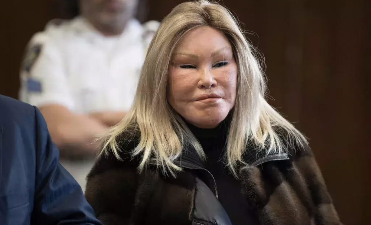 整容狂人乔斯林:嫁豪门失败,离婚分得25亿美元,如今怎么样了?