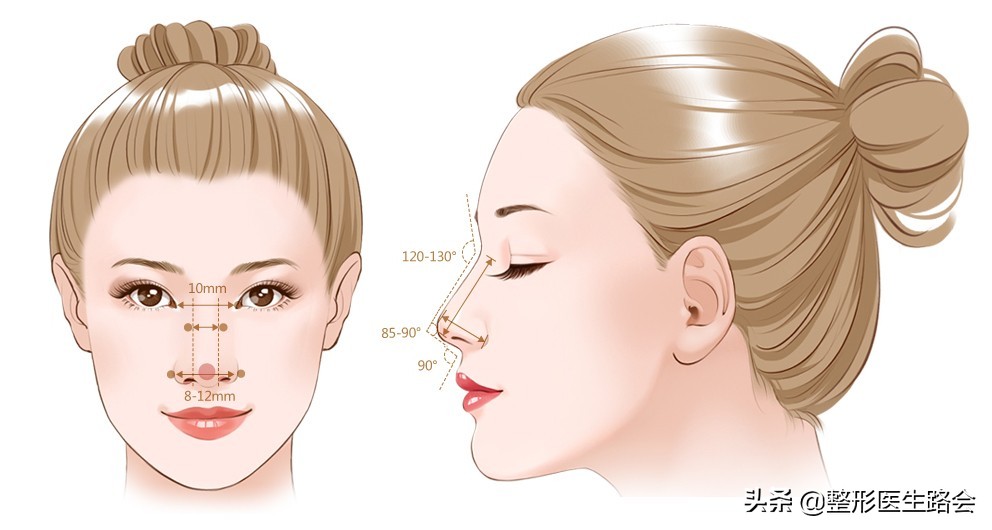 等待2年之久，从海南到北京，鼻整形真实记录，82天后“很惊艳”