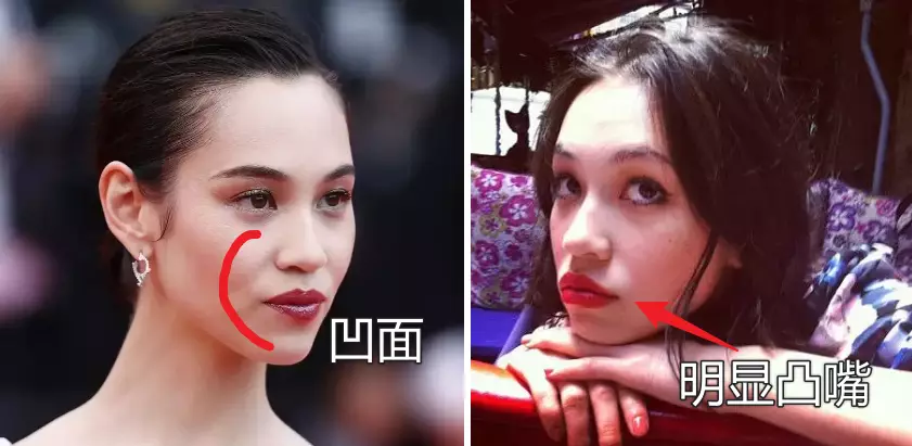鼻子塌不可怕，面中凹才拉胯，显苦显凶还显老，许多女星深受其害