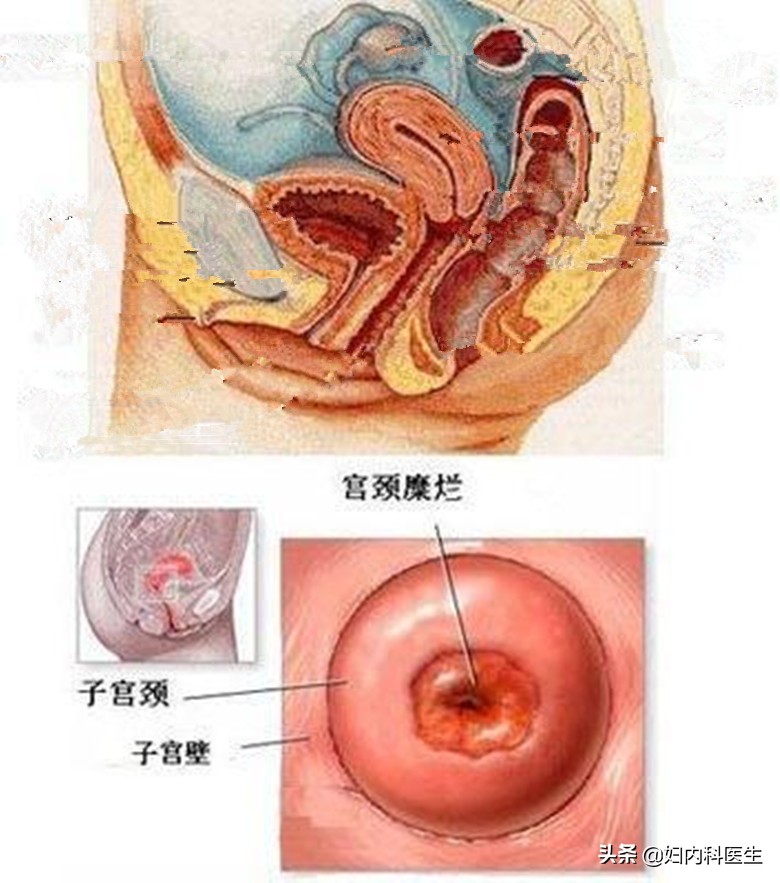 检查出来的一些病根本不需要担心，花冤枉钱治疗，别再傻傻地骗了