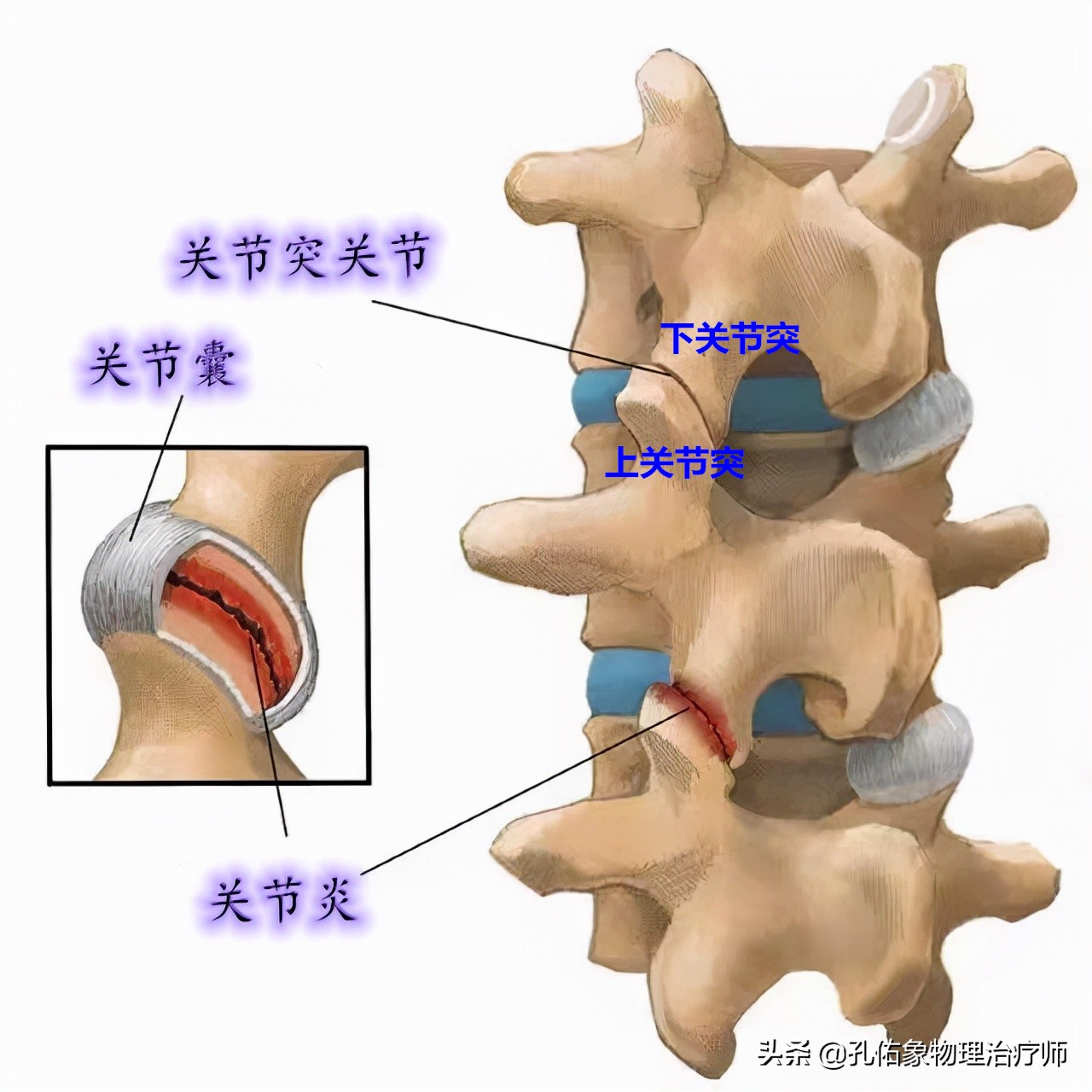 患了颈椎病，会有哪些症状？该如何治疗？