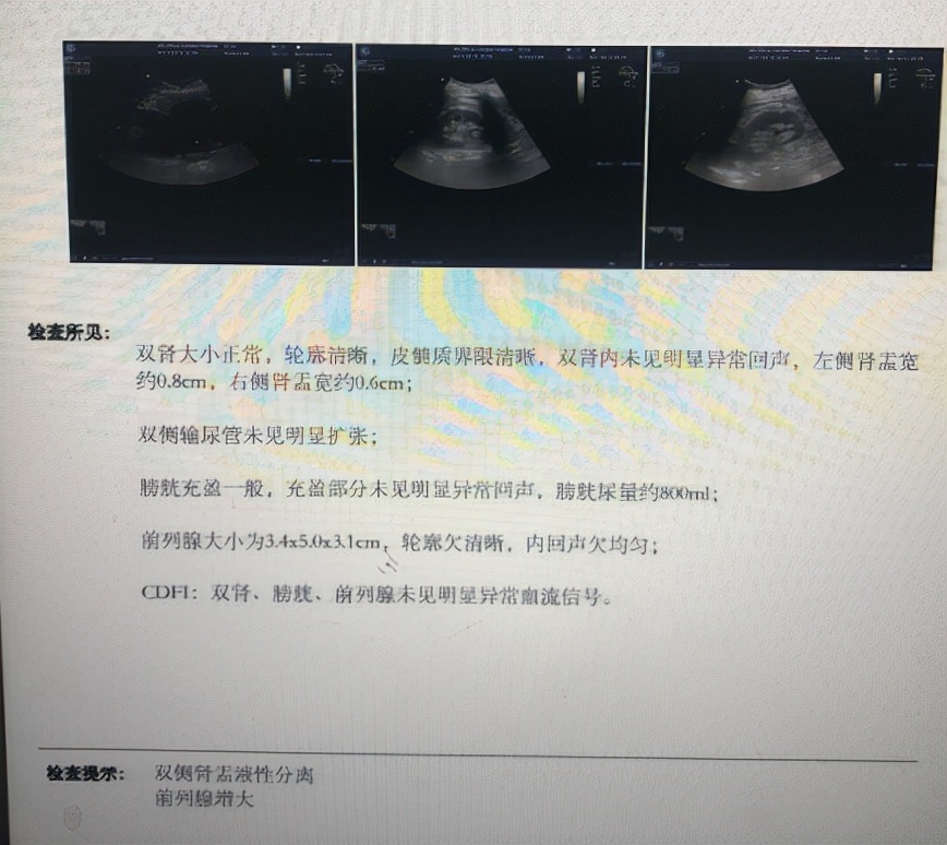 想尿却尿不出来？可能是这些原因在作祟