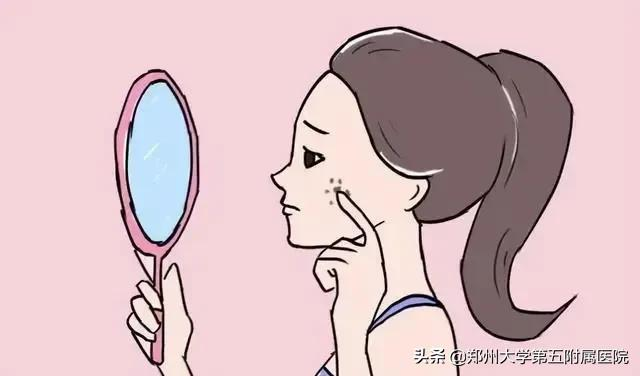 激光祛痣看似简单,这些却不得不知......