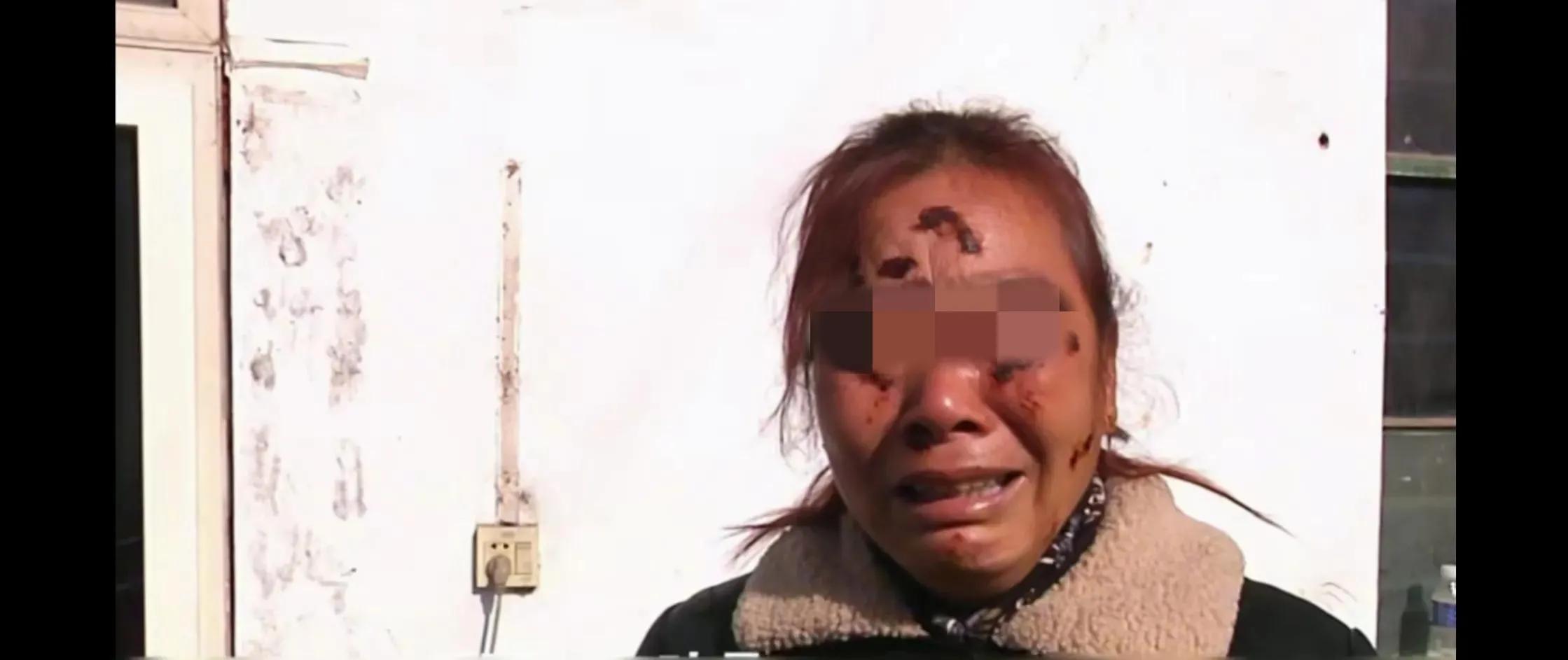 脸被抓烂，夜壶扣头，强势婆婆被儿媳按地上摩擦，儿子默不作声