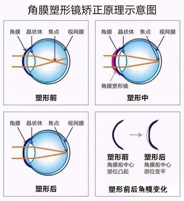 OK镜来了！你需要知道这几件事