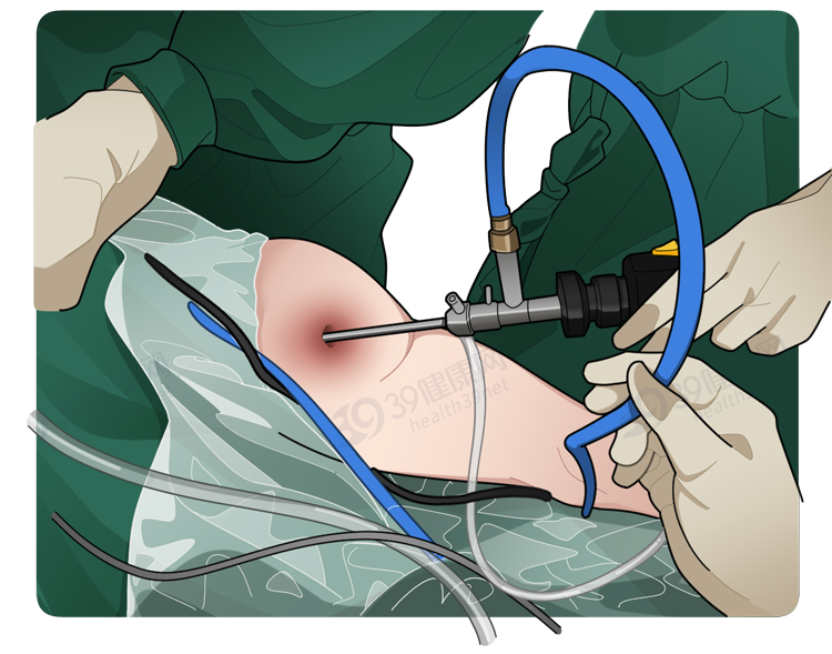 久坐对人体有什么危害？可能会得3种病，经常坐着的人看看吧