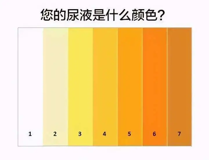 尿的颜色，能看出你得啥病？
