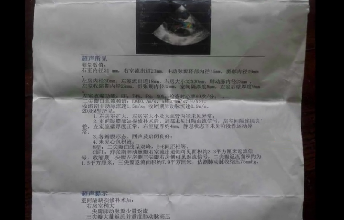 2014年，河南6岁女孩每天靠吃“伟哥”续命，爱心人士出手相助