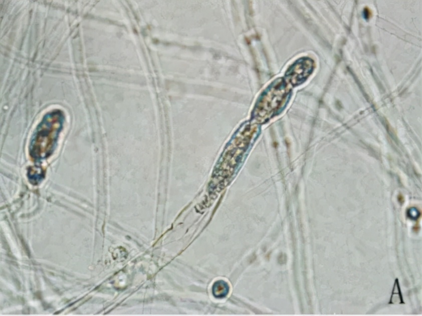 一文揭示，水产养殖中水霉菌繁殖和侵染过程