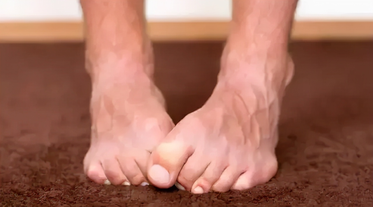 脚后跟痛？不要再忍了！医生提醒：可能与这3种疾病有关