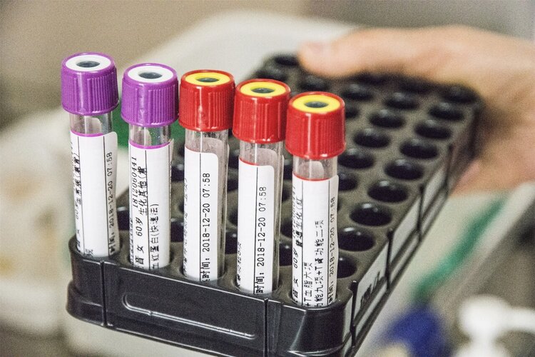 为啥一去医院看病就抽血？每天抽那么多血，最终都去哪儿了？