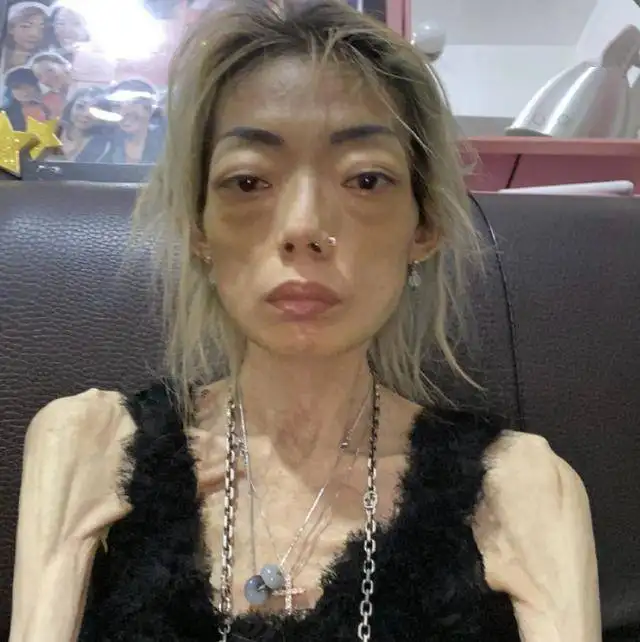 嫁入豪门的4位女星现状，有的瘦成44斤，有的为“爱”丢了性命