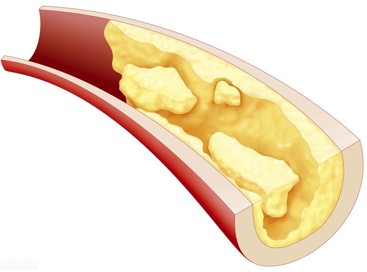 甘油三酯高是什么原因？医生提醒：超过这个正常值需要吃药了