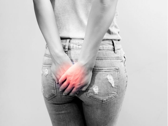 肛门癣的症状图片(肛门潮湿) - 赤虎壹号