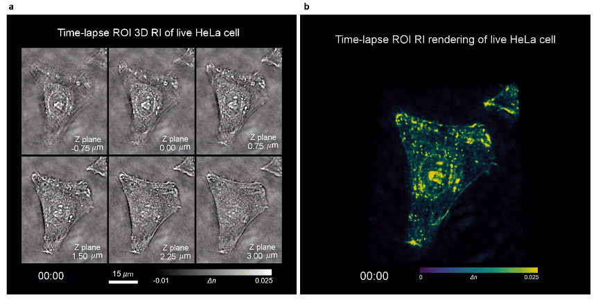 南京理工团队提出无需干涉及染色的三维层析显微成像技术