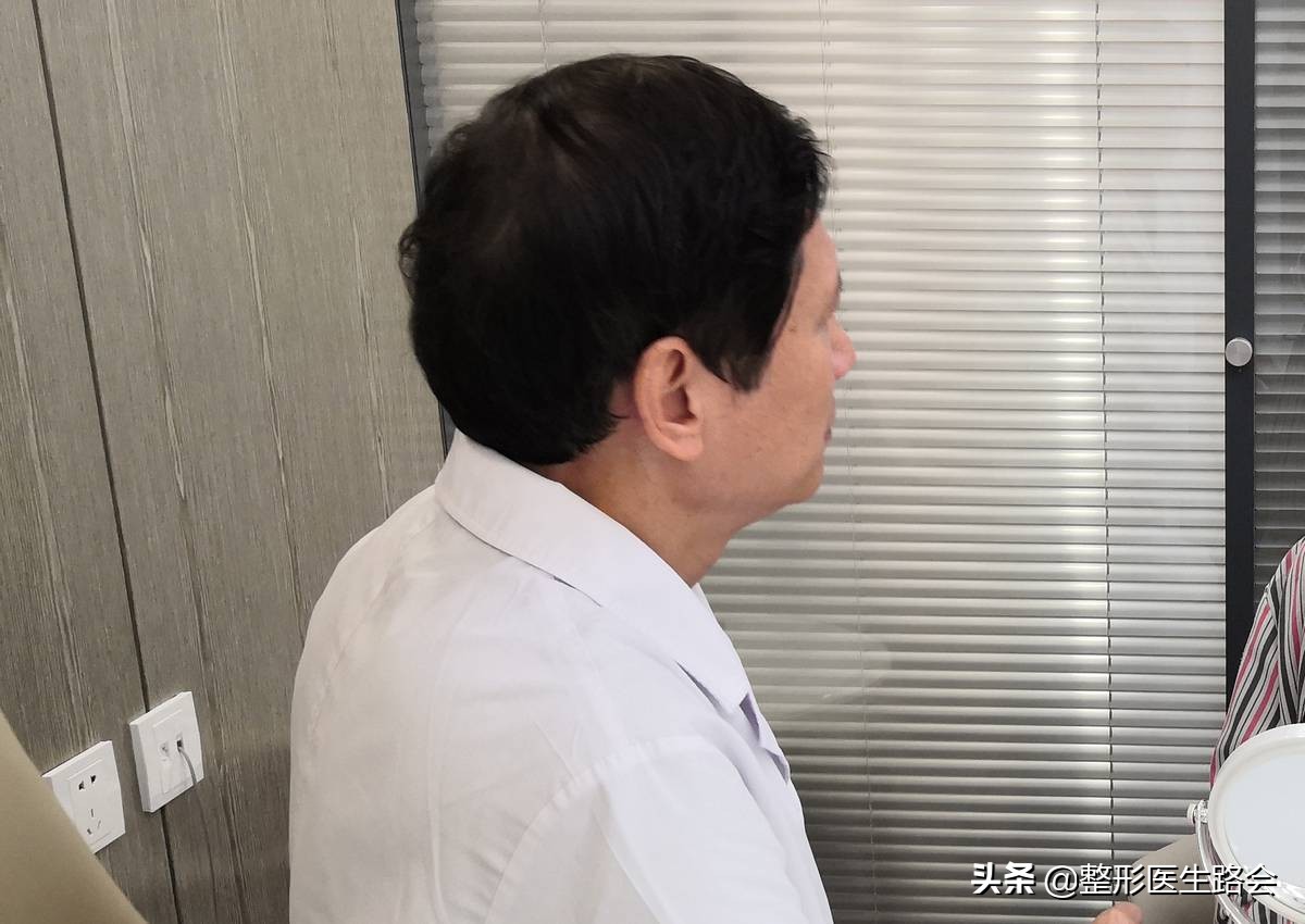 等待2年之久，从海南到北京，鼻整形真实记录，82天后“很惊艳”