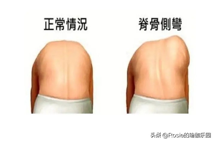 大S晒照美肩状态好，脊柱侧弯直角肩也不美，这样2步解锁好体态