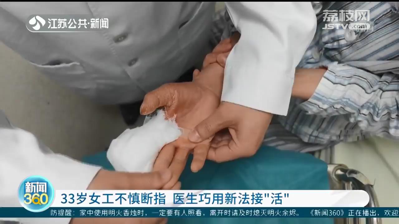年轻女工不慎断指 医生尝试新方法接&ldquo;活&rdquo;