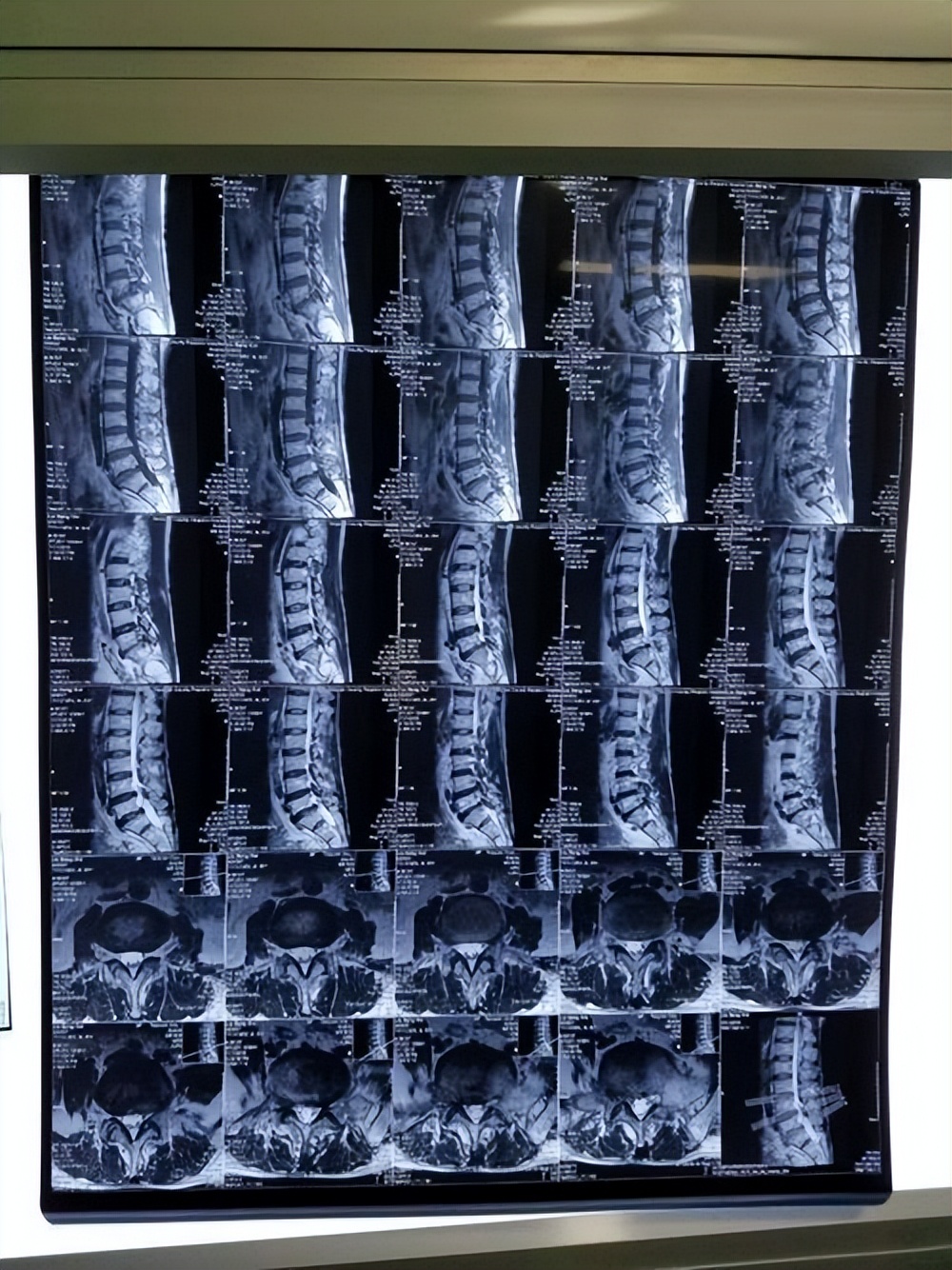 "核磁共振"不建议做?或许很多人还不明白,检查时要留意这3点