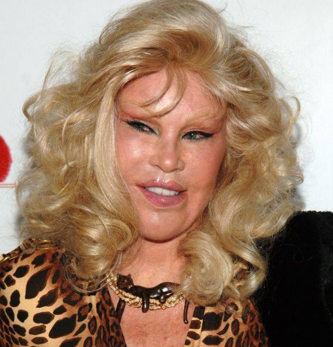 整容狂人乔斯林:嫁豪门失败,离婚分得25亿美元,如今怎么样了?