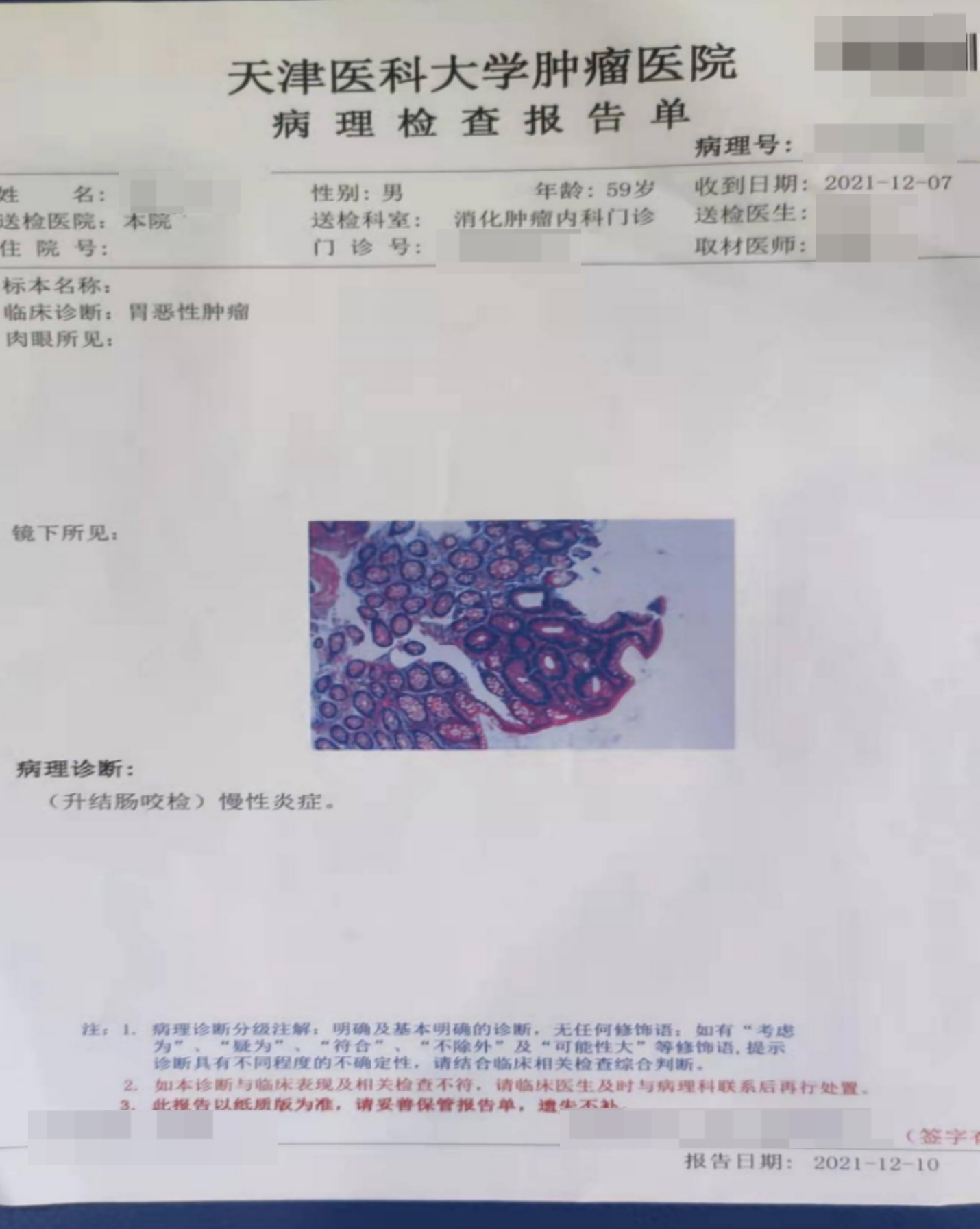 它是胃癌的罪魁祸首，一半中国人是阳性，却少有人重视