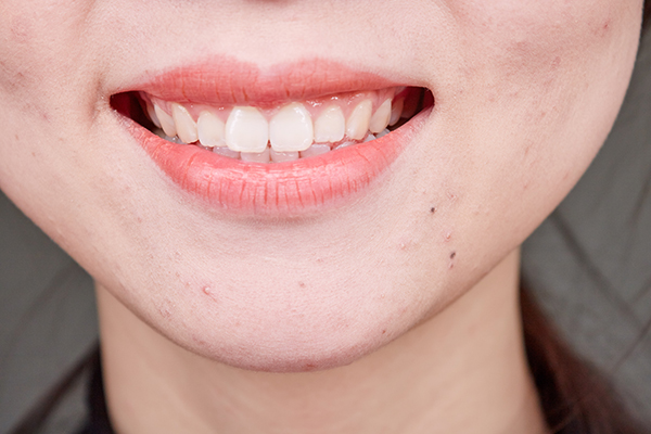 挖鼻孔、剔牙、拔倒刺，看似没事却暗藏危险的习惯，你占了几个？