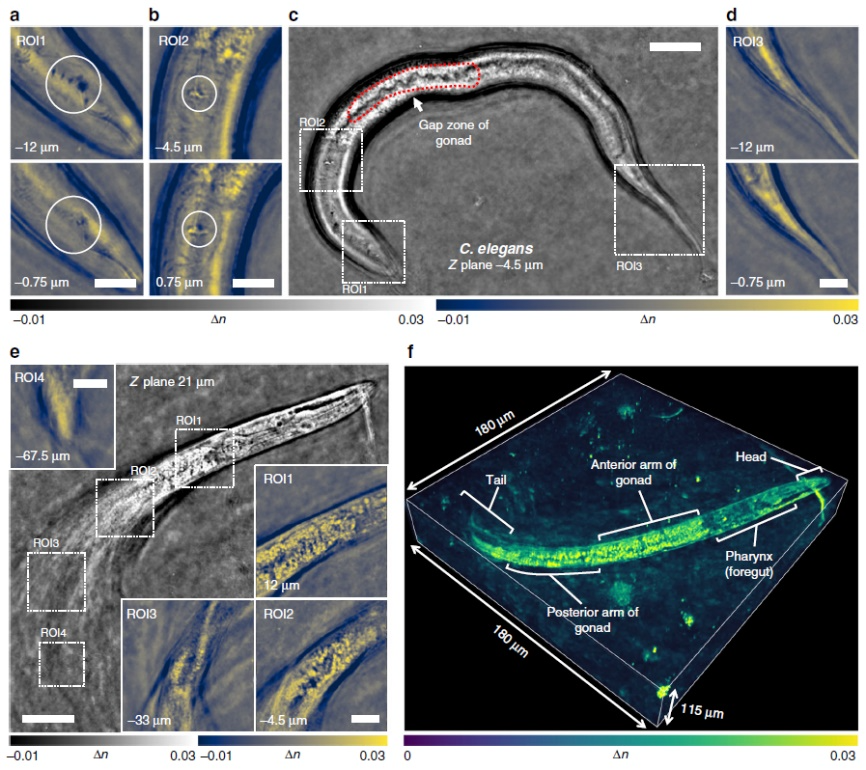 南京理工团队提出无需干涉及染色的三维层析显微成像技术