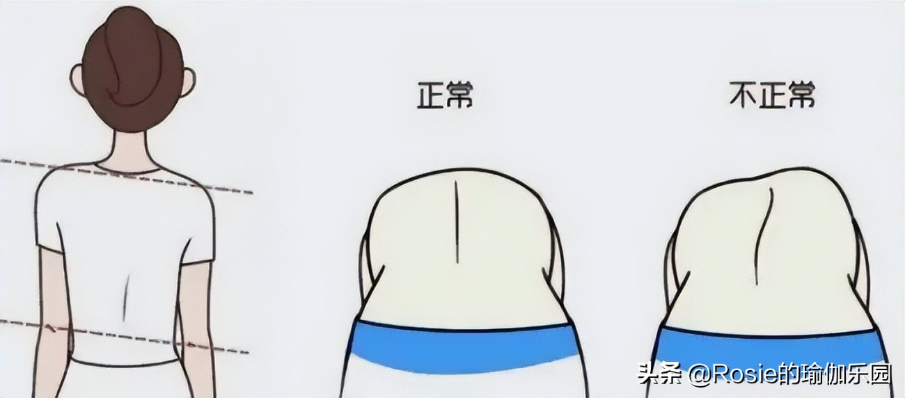 大S晒照美肩状态好，脊柱侧弯直角肩也不美，这样2步解锁好体态