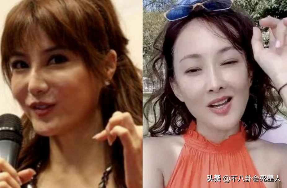 娱乐圈“假下巴”大赏，又尖又翘，一笑下巴原地起飞太吓人