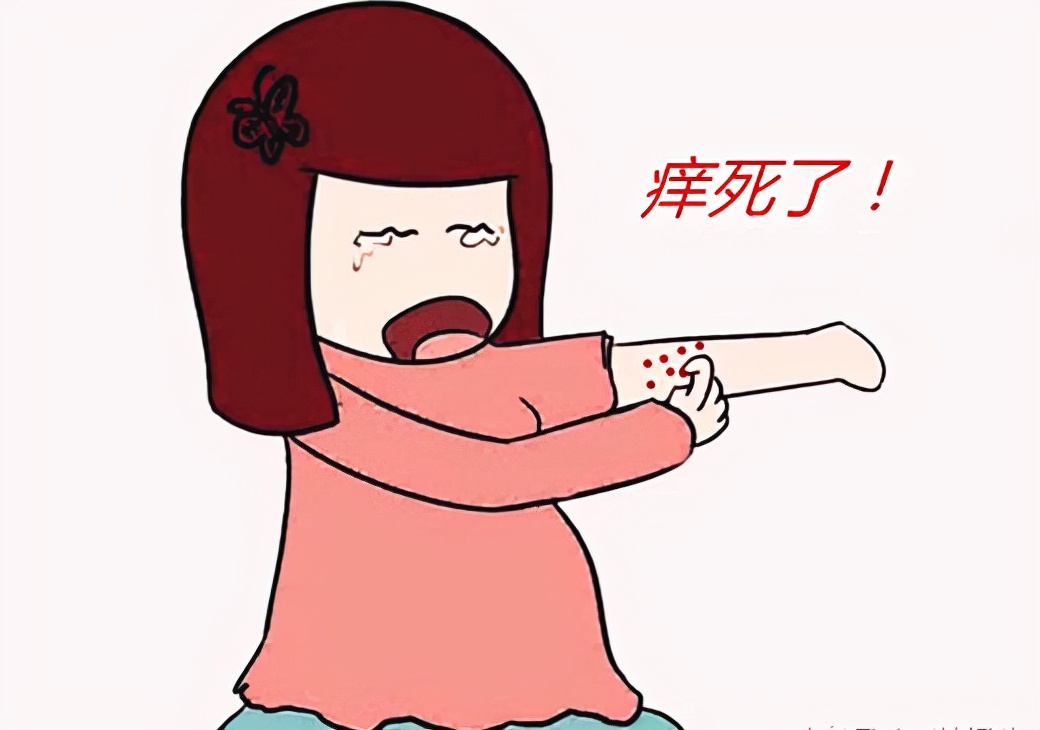 荨麻疹痒的难受？一剂消风散，消风清热，除湿止痒，有效解除风团