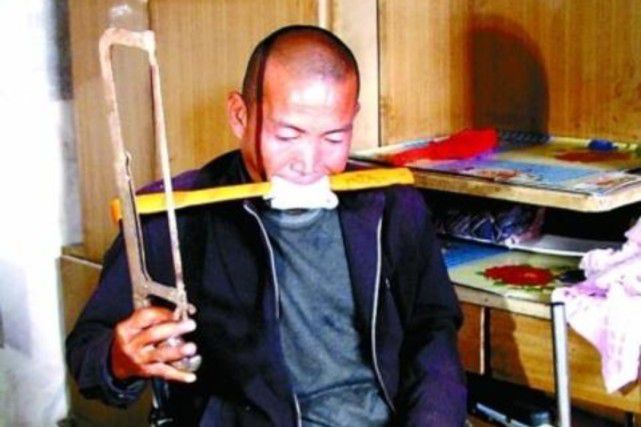 2012年河北农民“锯腿求生”：击垮一个普通家庭，只需要一场大病