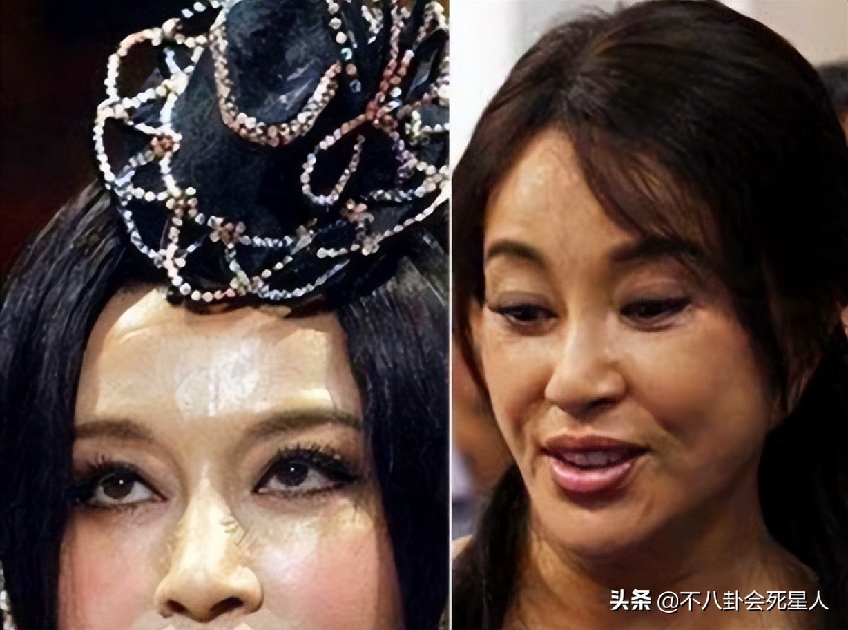 娱乐圈“假下巴”大赏，又尖又翘，一笑下巴原地起飞太吓人