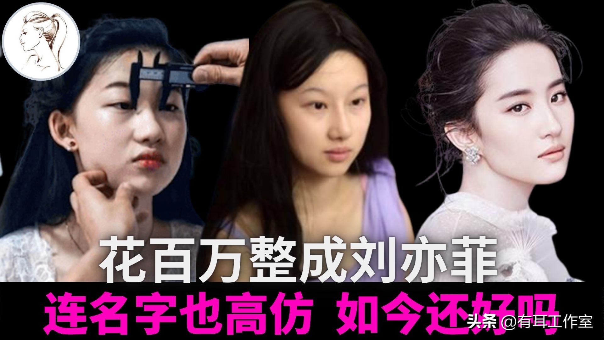 19岁女生花百万整容成“刘亦菲”，连名字也高仿，现在如何？
