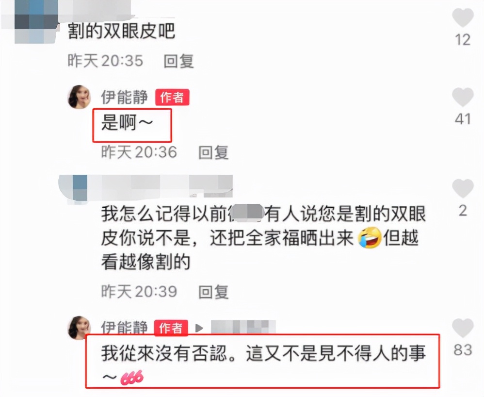 伊能静罕晒5岁女儿正脸，米粒龅牙突出嘴唇略厚，被疑腺样体肥大