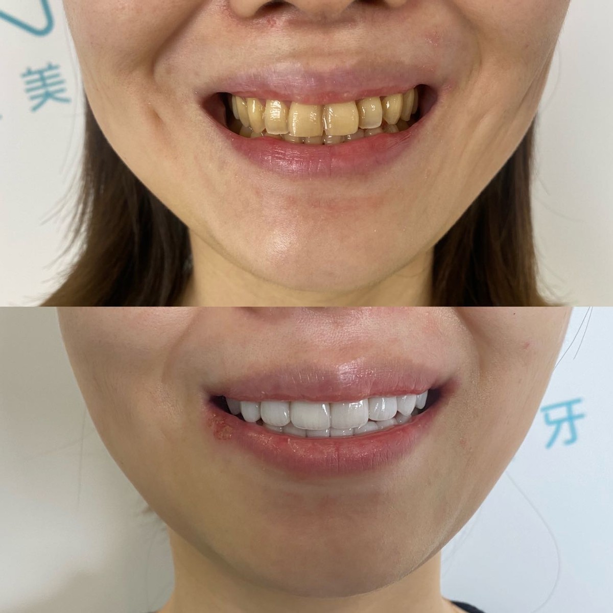 洁蔻美牙的部分案例