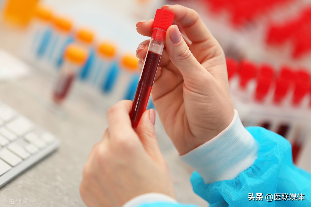 血液粘稠是小事？这3个麻烦事可能也会来，得尽早避开