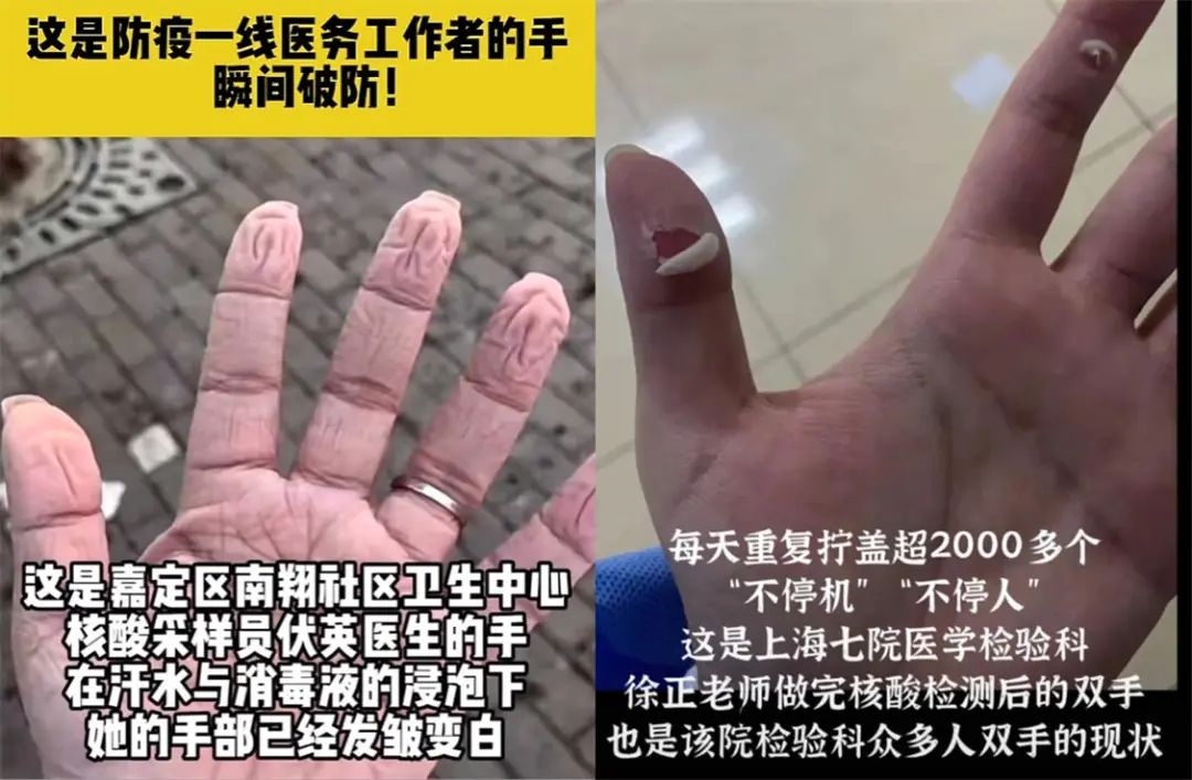 拿防疫人员当流量密码，你没事吧？