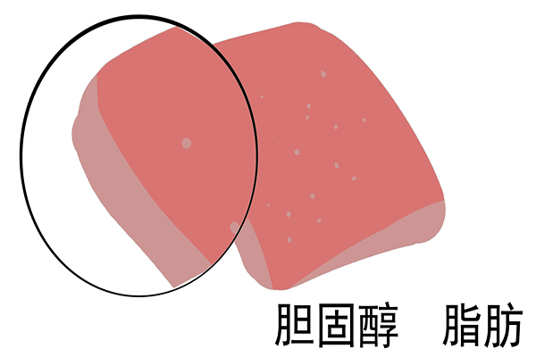 一天到底吃几个鸡蛋好？蛋黄吃不吃？终于知道靠谱的答案了